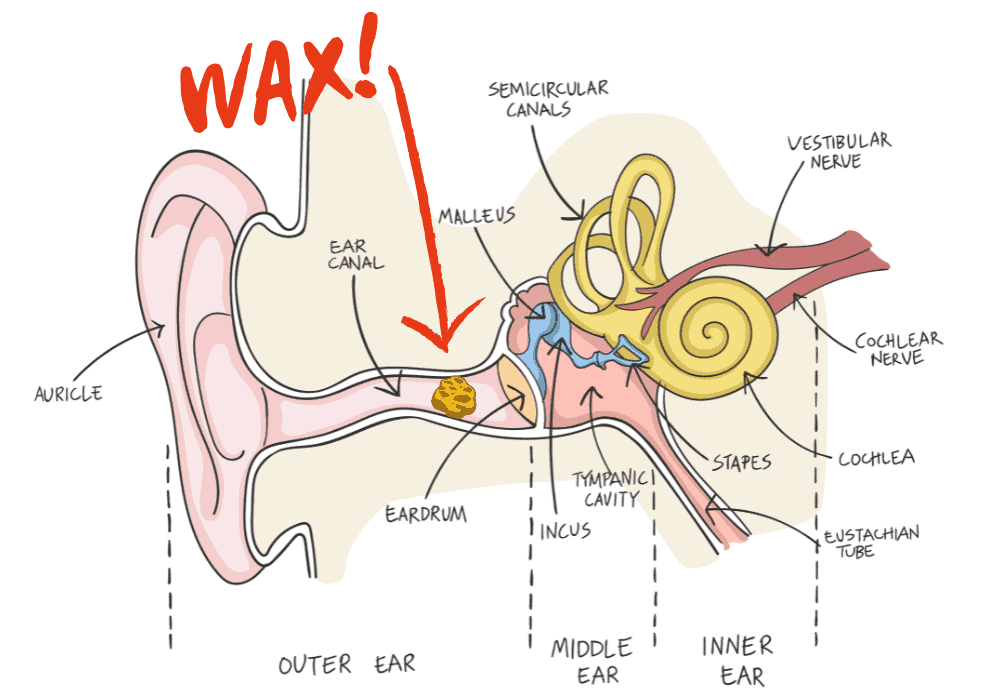 Earwax Diagram
