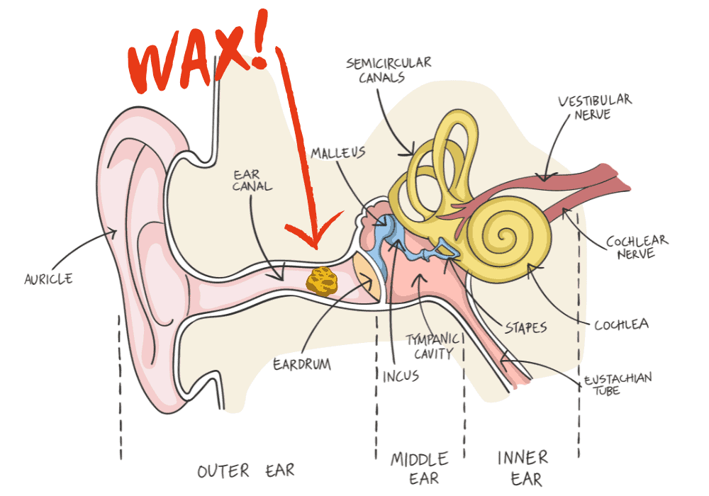 All About Ear Wax Removal